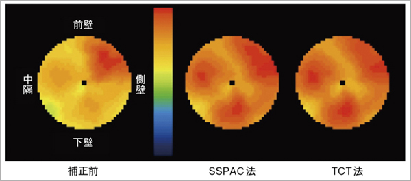 }3@TCT@Ƃ̔ri99mTc Tetrofosminł̐j