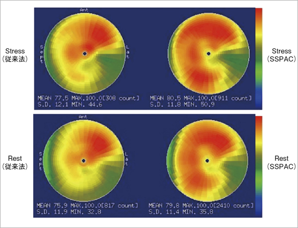 }5@99mTc-MIBIɂ鑤Ǎ[Ǘ