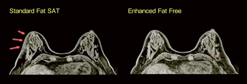 }2@Enhanced Fat Free