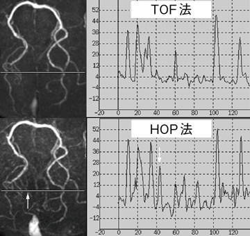 }5@HOP-MRATOF̃VOiEvt@COJ[u̔r