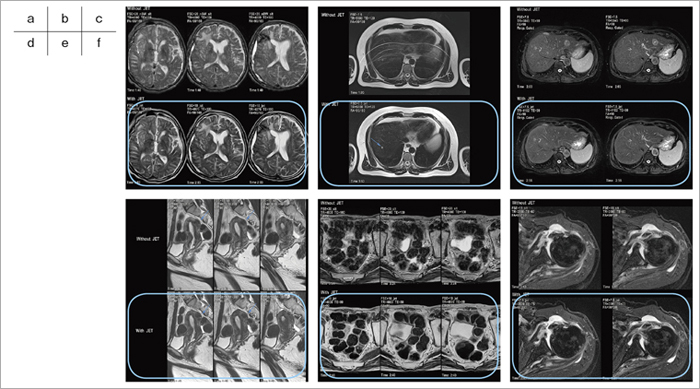 }8@ëɂJETƏ]@̉摜rigJET@j