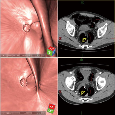 }1@Rr[CO\tgEFAɂ2̈ʔr\