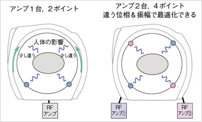 }4@RFAvƃ|Cg𑝂₷ƂɂʑƐU̍œKiC[W}j