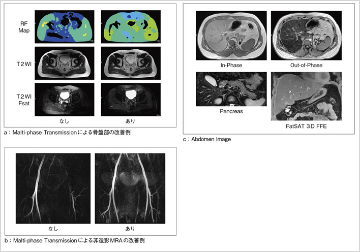 }5@Multi-phase TransmissionB