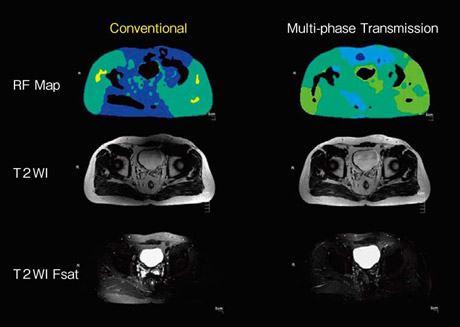 }2@]MMulti-phase Transmission̉摜r