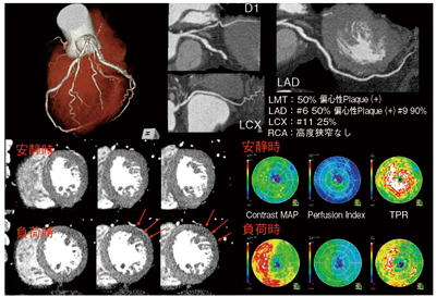 }3@S؟CT摜 ׉摜ŁCAntero-lateralɌyx̔ZsǂB i摜񋟁FVa@lj