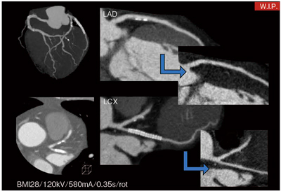 }4@TugNV摜 i摜񋟁Fȑwa@ zÃZ^[lj