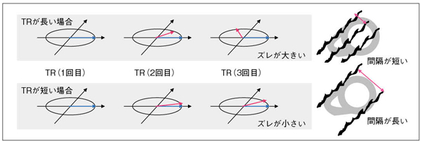 }4@TR̈Ⴂɂʑ̈ႢiC[W}j