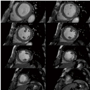 }8@œKȒɂ蓾ꂽCine MR摜 if[^񋟁FǗёwwta@lj