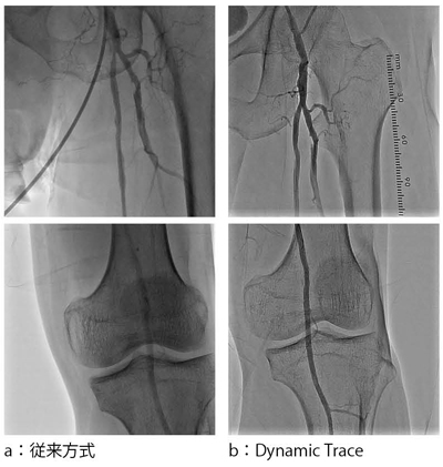 }6@ꊳ҂ɂ鉺Be̔r BeCeܗʂ͈قȂB