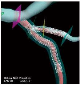 }7@StentPlannerɂ鉼zXeg\