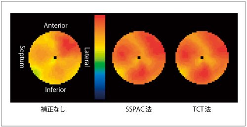 }3@O@iTCT@jƂ̔rF99mTc-tetrofosminł̐ if[^񋟁FcیqwlCOdwlj