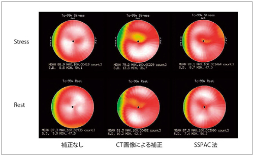 }5@SPECT-CTCT摜g␳SSPAC@ɂ錸␳̔r if[^񋟁Fwlj