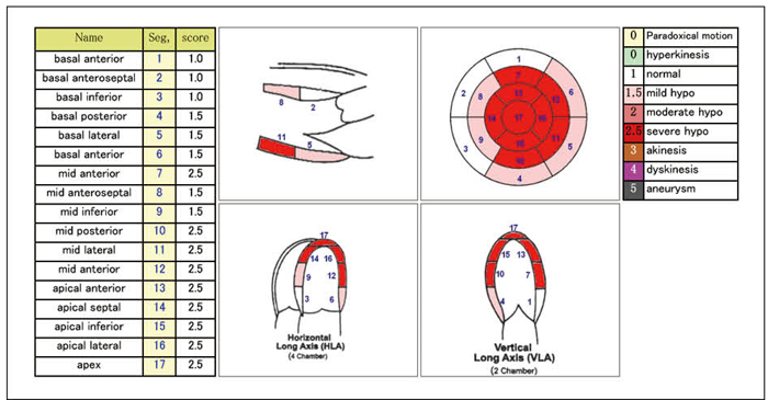 }6@Wall Motion ScoringiWMSj eǂ̉^]Bʂ͐F`[gɂȂ̂ IɗłB