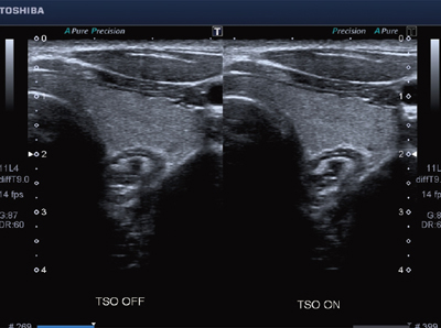 }2@TSOĂẺ摜ł͕ʕ\サĂ