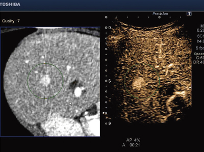 }3@aϕʂCTƒg̗ώ@Smart Fusion