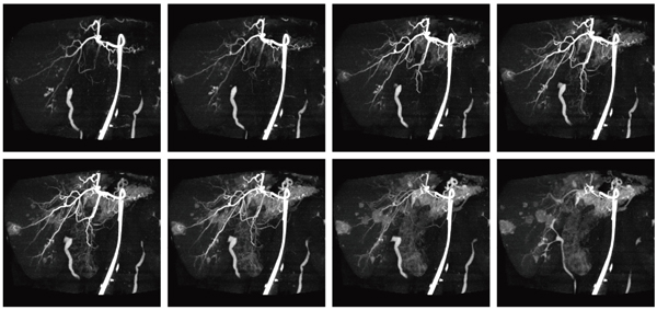 }2@Dynamic Volume Scanp̍זEpOi摜񋟁FÖ@l Ylj