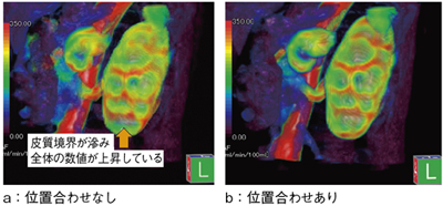 }3@Body PerfusionitזE񑽔]ځj