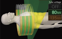 }4@Dual Energy Helical Scan wʔ