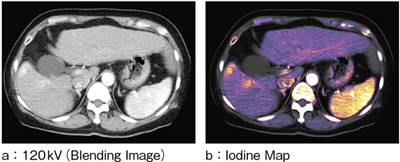 }5@Dual Energyi̍זEj