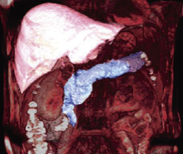 }4@Enhanced Fat Free@ɂ镠b}摜iVRj