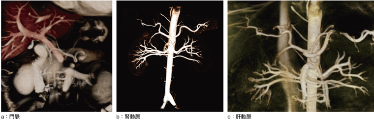 }5@Time-SLIP@ɂ镠񑢉eMRA摜