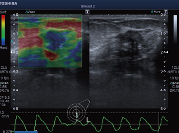 }4@ElastographyiBᇁj