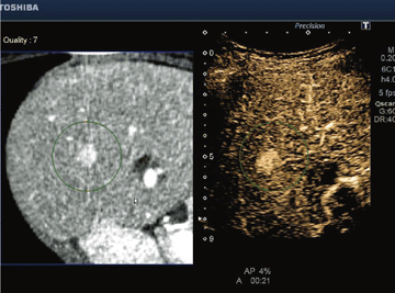 }6@Smart FusioniGR[CTA̍זEj