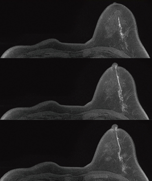 }2@Б؏̏ꍇłCMxƎb}Ȃψɕ`o