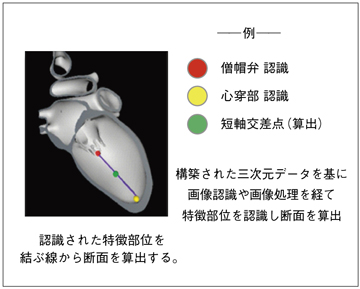 図3 特徴部位認識技術