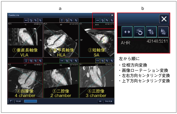 図4 CardioLine設定画面