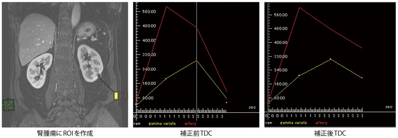 図1 Dynamic 4D解析 呼吸差や姿勢差などによる位置ズレを補正し,正確なTDCを描画できる。