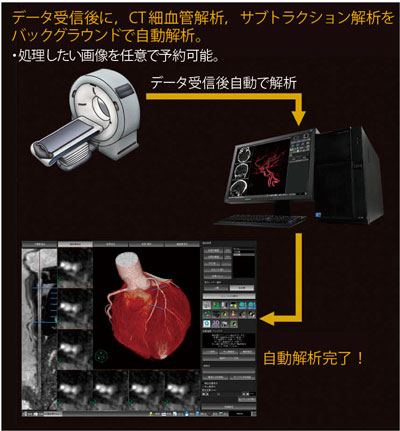 図4 AZE Auto Analyzer データを自動解析し,結果はネットワークを介してすぐに参照できる。