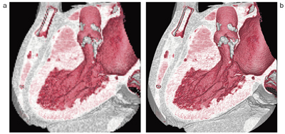 図5 従来法(a)とFORMULAによる4Dレンダリング(b)の比較