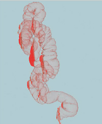 図2　 大腸CT2日法による 仮想注腸像側面 残液を赤で表す。少ない残液で解析が行いやすい。 