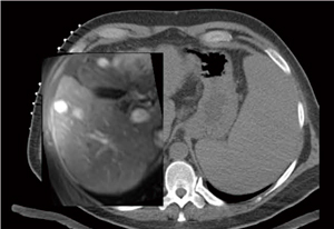 }1@CTÛĎ܏pɂpCTƏpOMRI̕ό` ic`mwуn[o[hwF 搶񋟁j