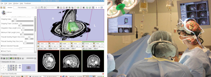}2@p\tgEFAƘAgďpgNgOtBs3D Slicer