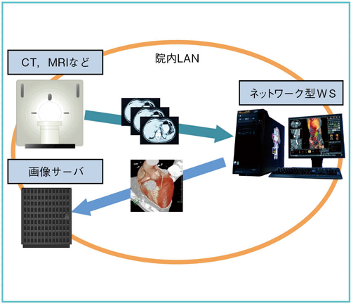 図1 ネットワーク型WSにおけるDICOM画像送受信