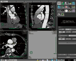 ׌ǉ̓AvP[VɂāC哮ó͈CENnw肵sB