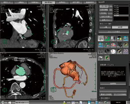 哮CE𒊏oBȂǂŁC𖖏܂ŒǐՂłĂȂꍇ́CǉŒǐՍƂsB