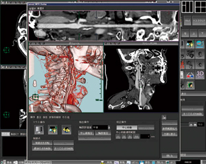 򓮖x ̒xE͈͂ڍׂɕ`oĂBÖ@̌ɂĕKvȋ󕔂̍ΊDɂĂCȕւɕ]邱ƂłB摜͏ォCPRCVRiijCMPRiiEjB