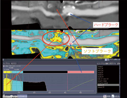 zǋiv−NjǗ̉́F3D-CTAngioǓÏpO]