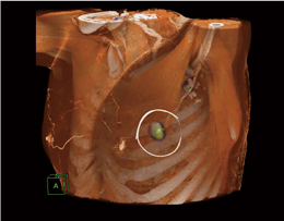 pOPET/CT iFDG-PETƑeCT̗Zj