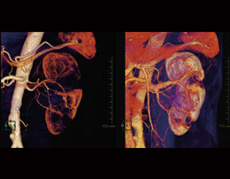 ~}ɂ郏[NXe[V̊p`Otɂā` 