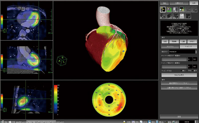 }5@CTRi[ƃV`OtB3Dt[W