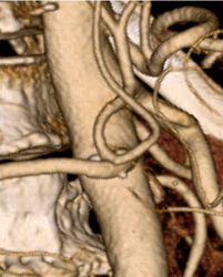 }12@]̃_O ivObVuj ]IpVeBς肷ƁC̃_Oi𑜓xjɂȂB