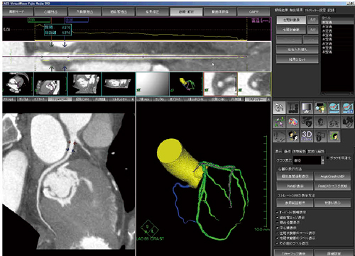 }2@AZE Auto Analyzerɂ鎩