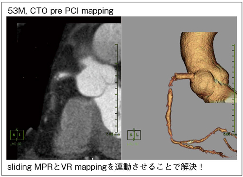 }4@2D摜3D摜APCIpO}bsO 