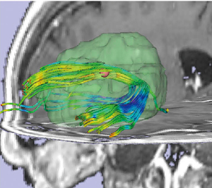 }4@gNgOtBɂC^NeBuȐ_oH̕`o