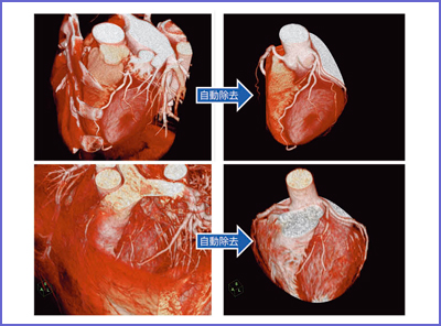 }5@xSo@\iFCT摜CFMRI摜j